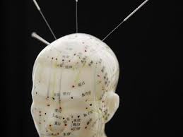 formation acupuncture